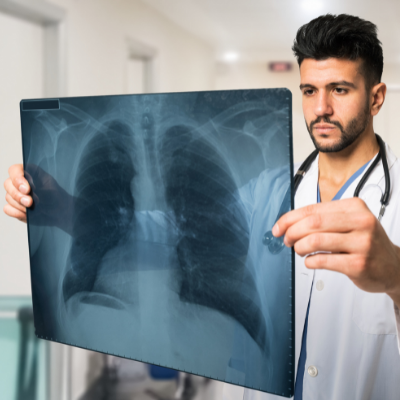 doctor holding CT scan of pulmonary nodules Pulmonary Associates of Richmond